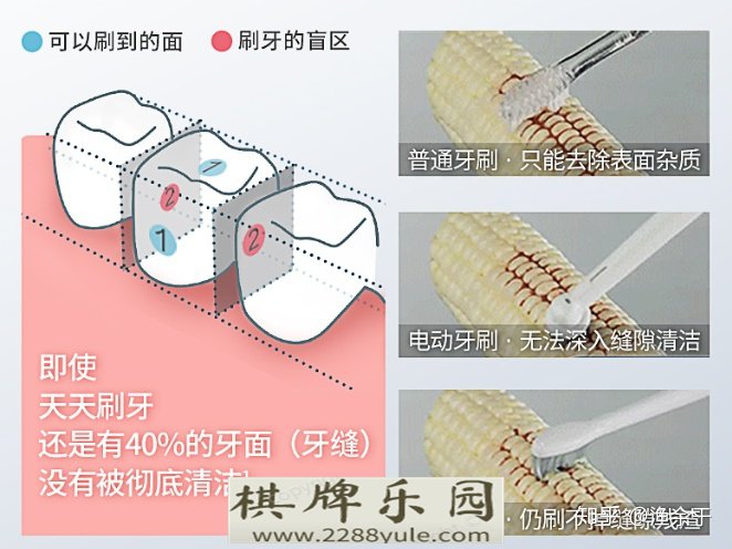 有人用水牙线吗可以每天用吗会不会太频繁对牙